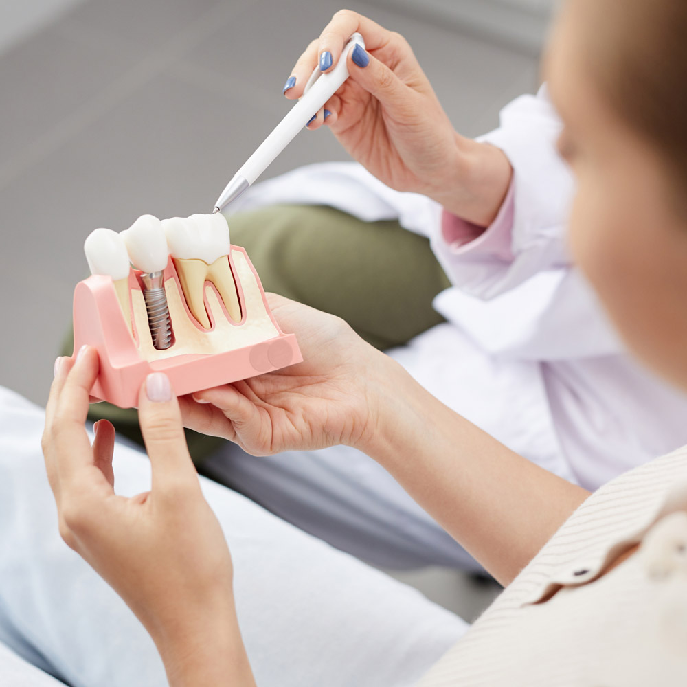 Dental Implants Louisville Dental Associates
