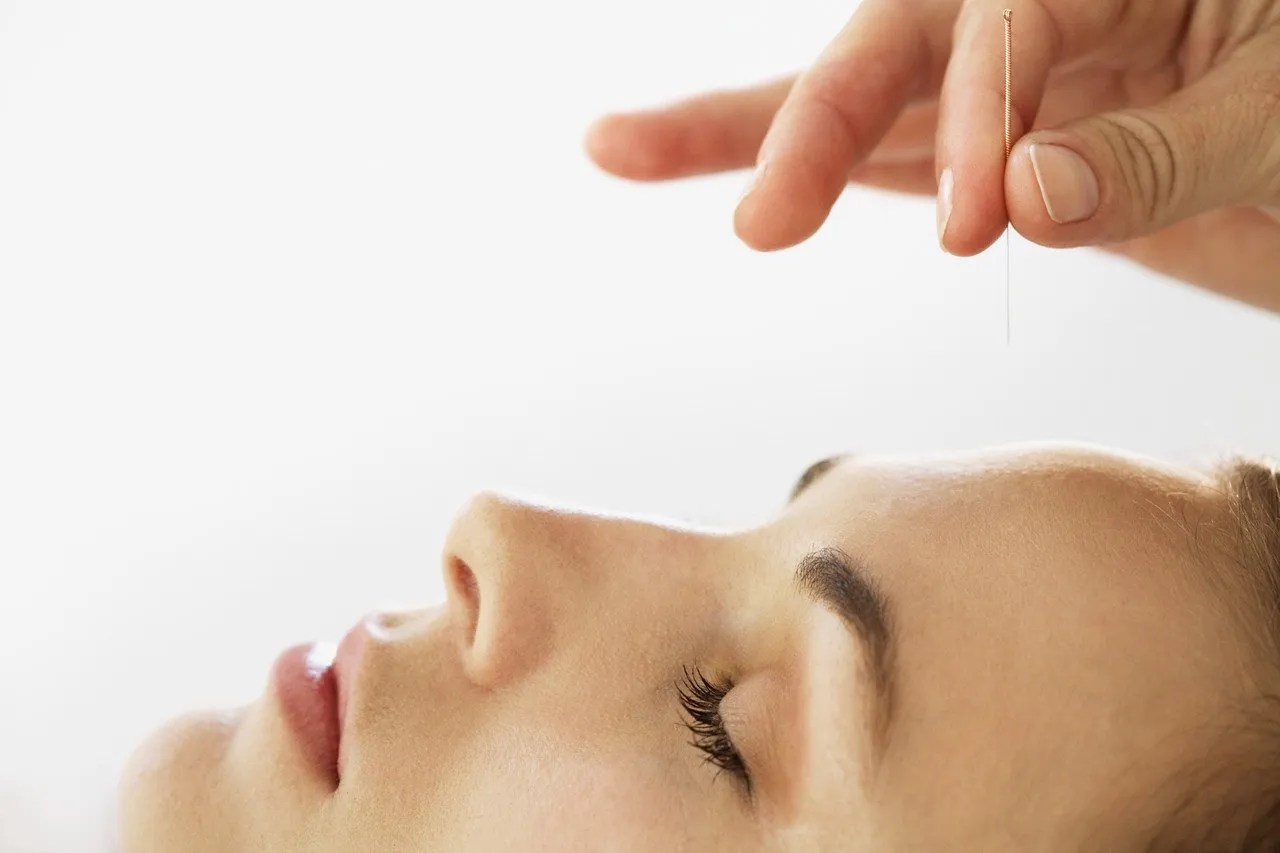 Facial (Cosmetic) Acupuncture Guildford Surrey The Acupuncture Clinic