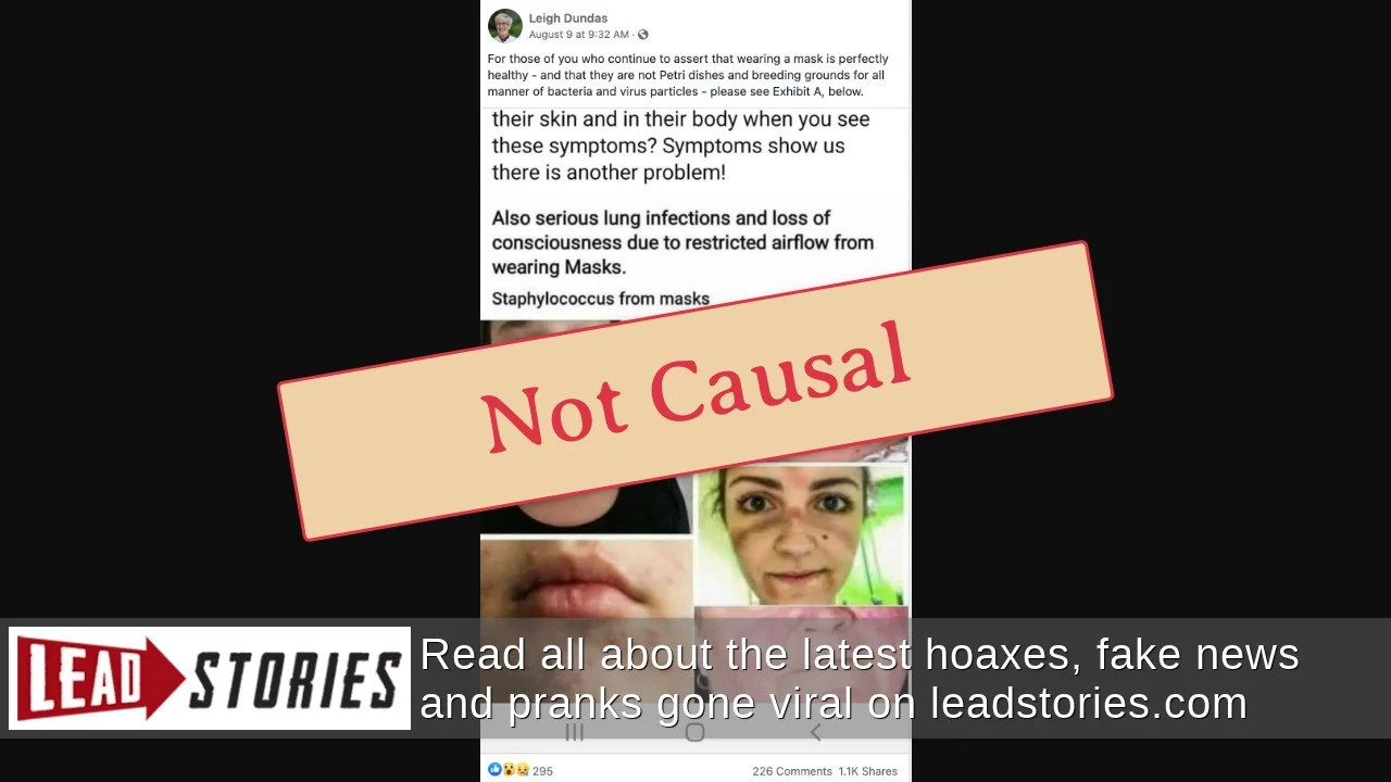 Fact Check NO Evidence That Face Masks Cause Staph Infections Lead