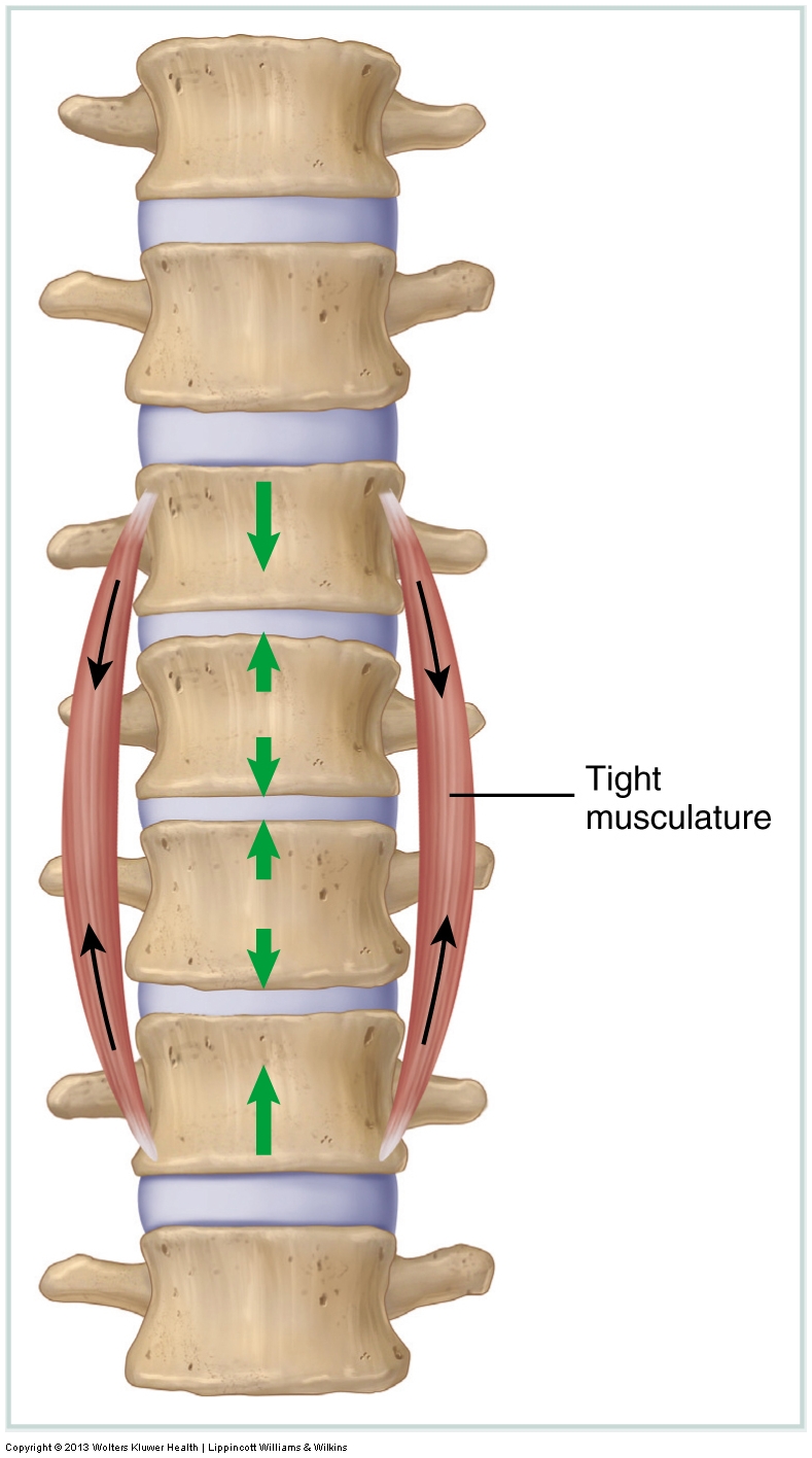 Psoas Major Function Stabilization of the Spine by the Psoas Major