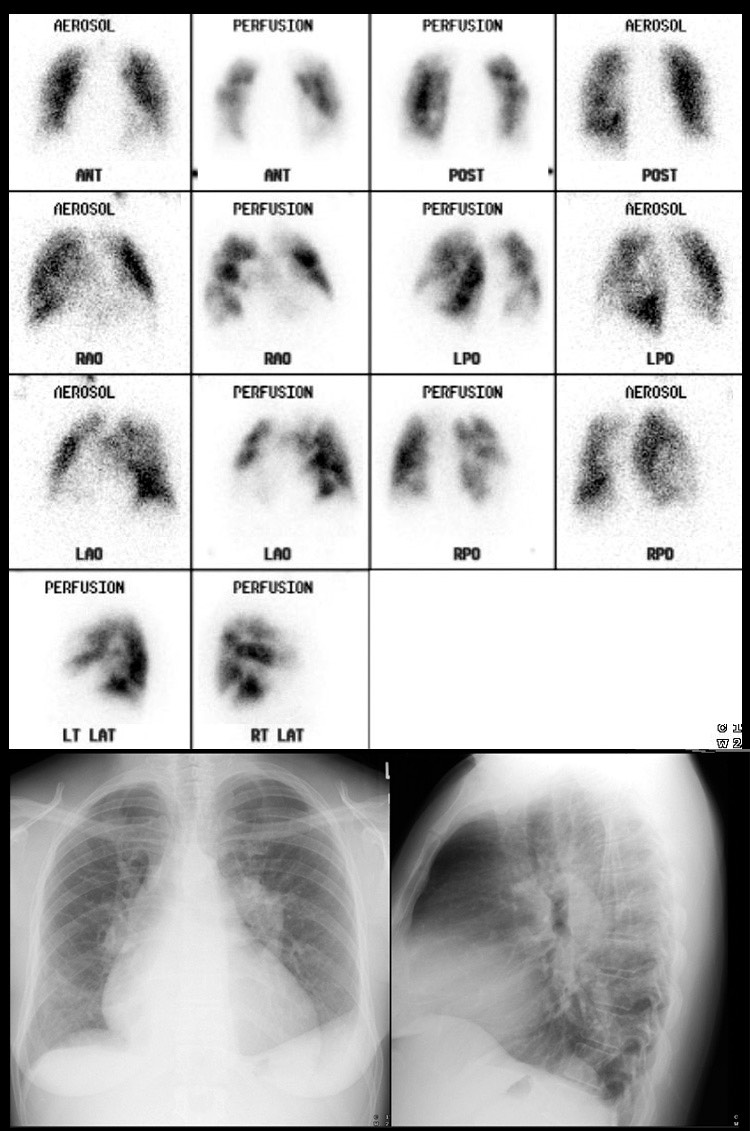 The Volume on Renal and Lung Scintigraphy Clinical Nuclear Medicine