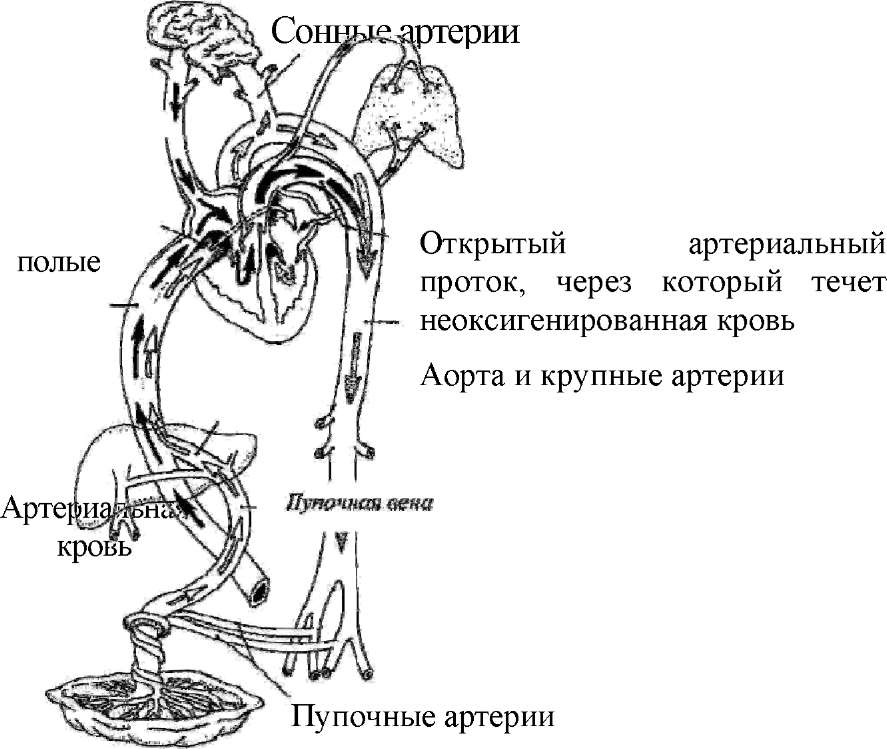 Схема кровообращения плода. Открытый артериальный проток гемодинамика схема. Внутриутробное кровообращение плода схема. Открытый Сонный проток. Гемодинамика схематично.