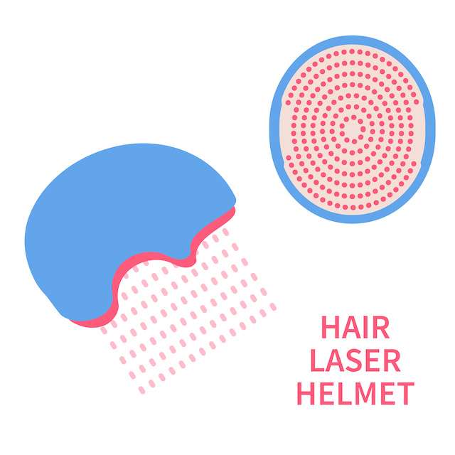 5 Benefits of LowLevel Laser Light Therapy for Hair Loss Boost Hair