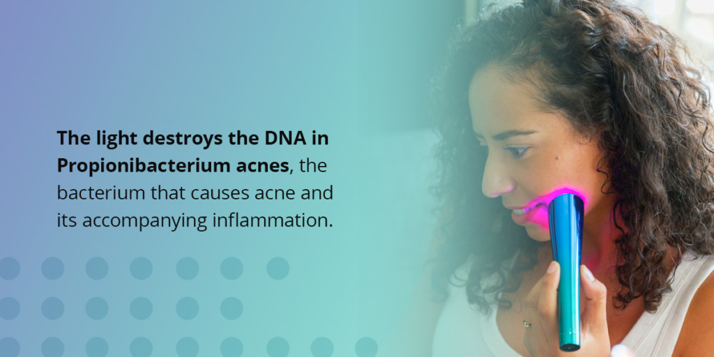 Benefits of Blue Light Therapy Products for skincare