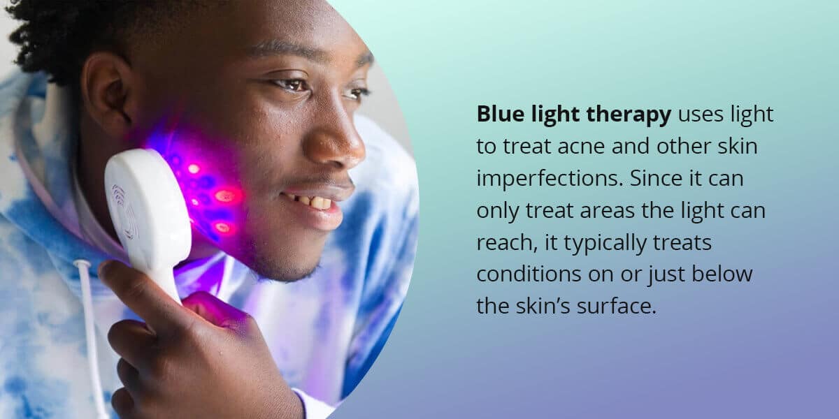 How are Red and Blue Light Therapy Devices Different?