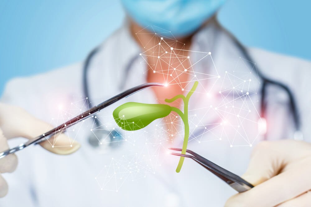 Cholecystectomy All You Need to Know About Gallbladder Removal Left