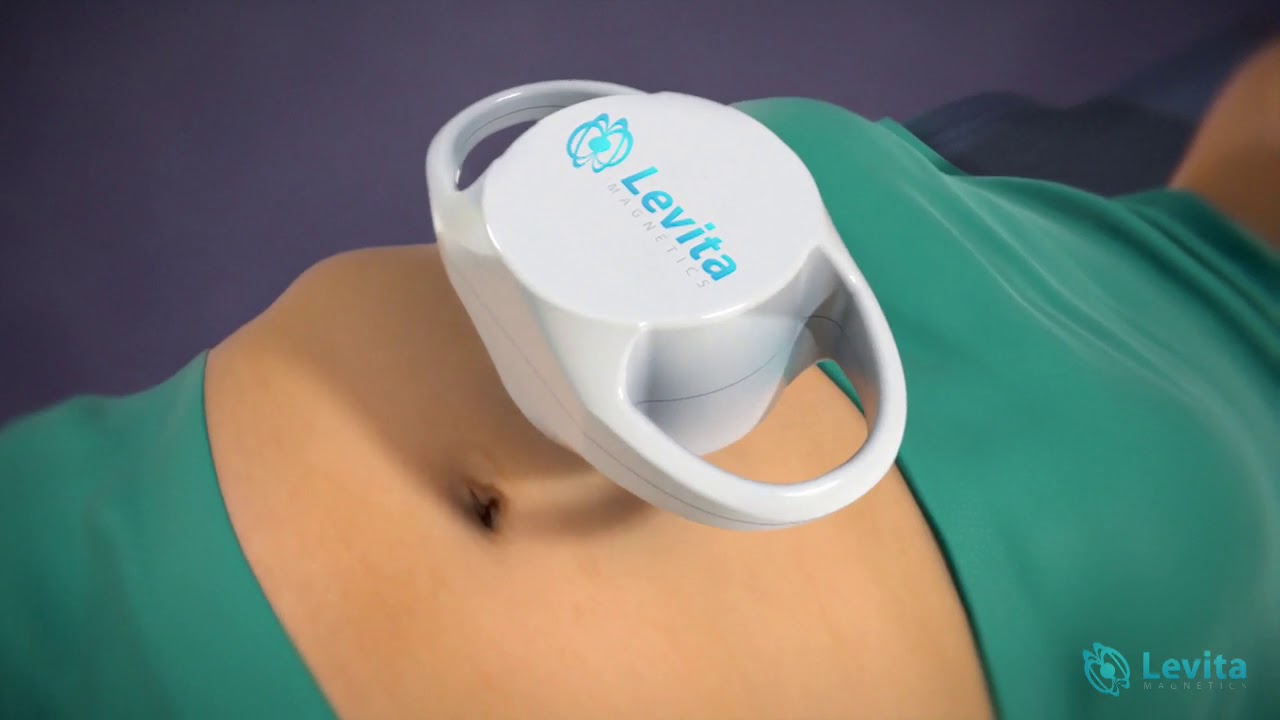 Levita Announces 1,000th Surgery Procedure