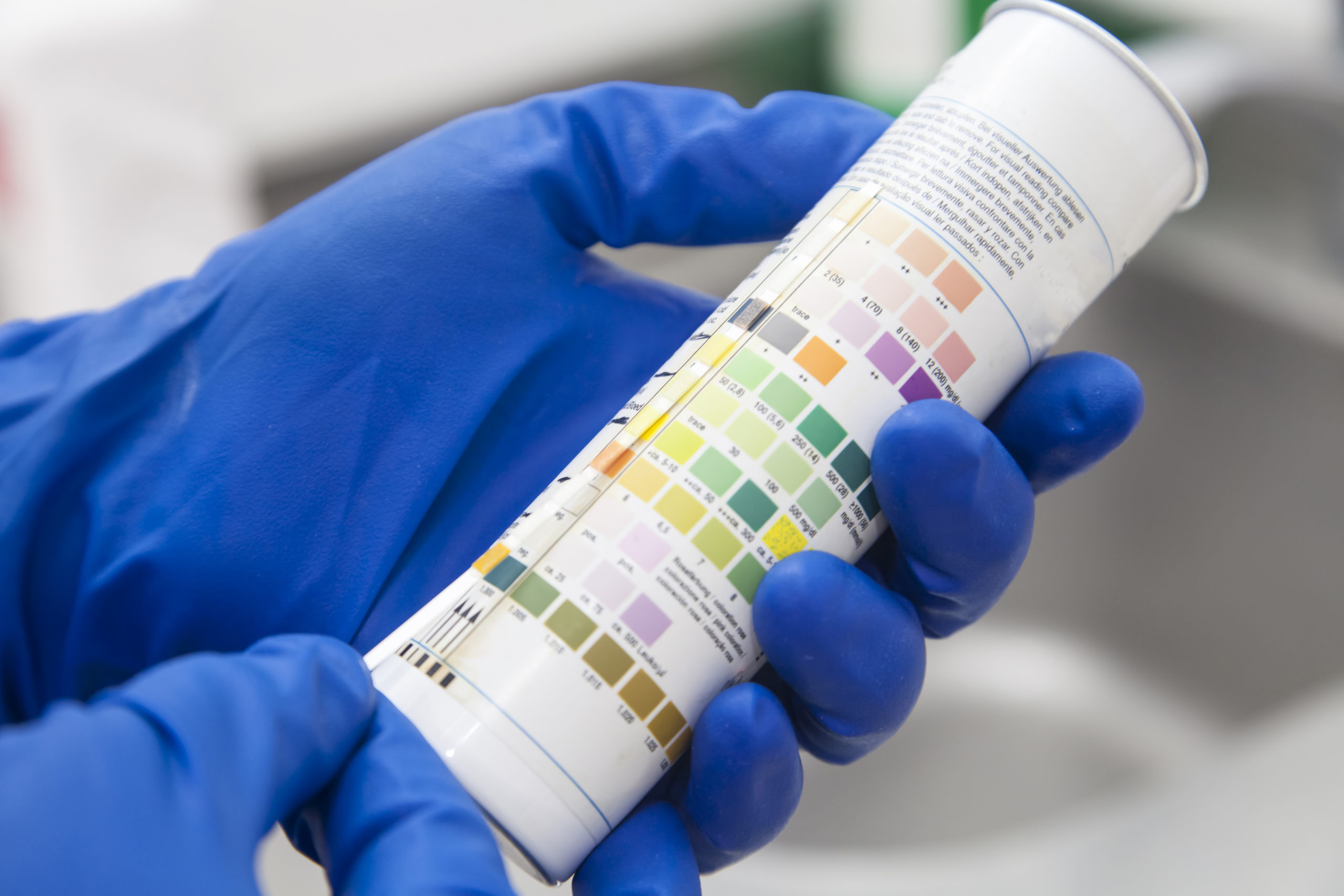 Urine Drug Screens The Addition of Routine Fentanyl Screening to