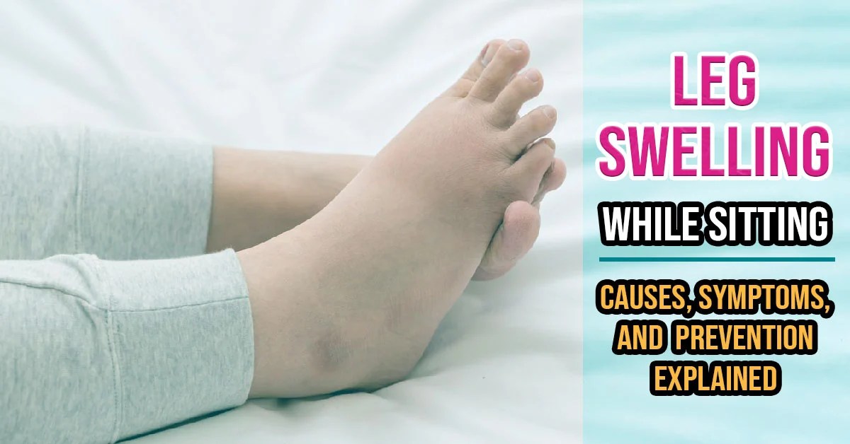 Leg Swelling While Sitting Causes, Symptoms, and Prevention Explained