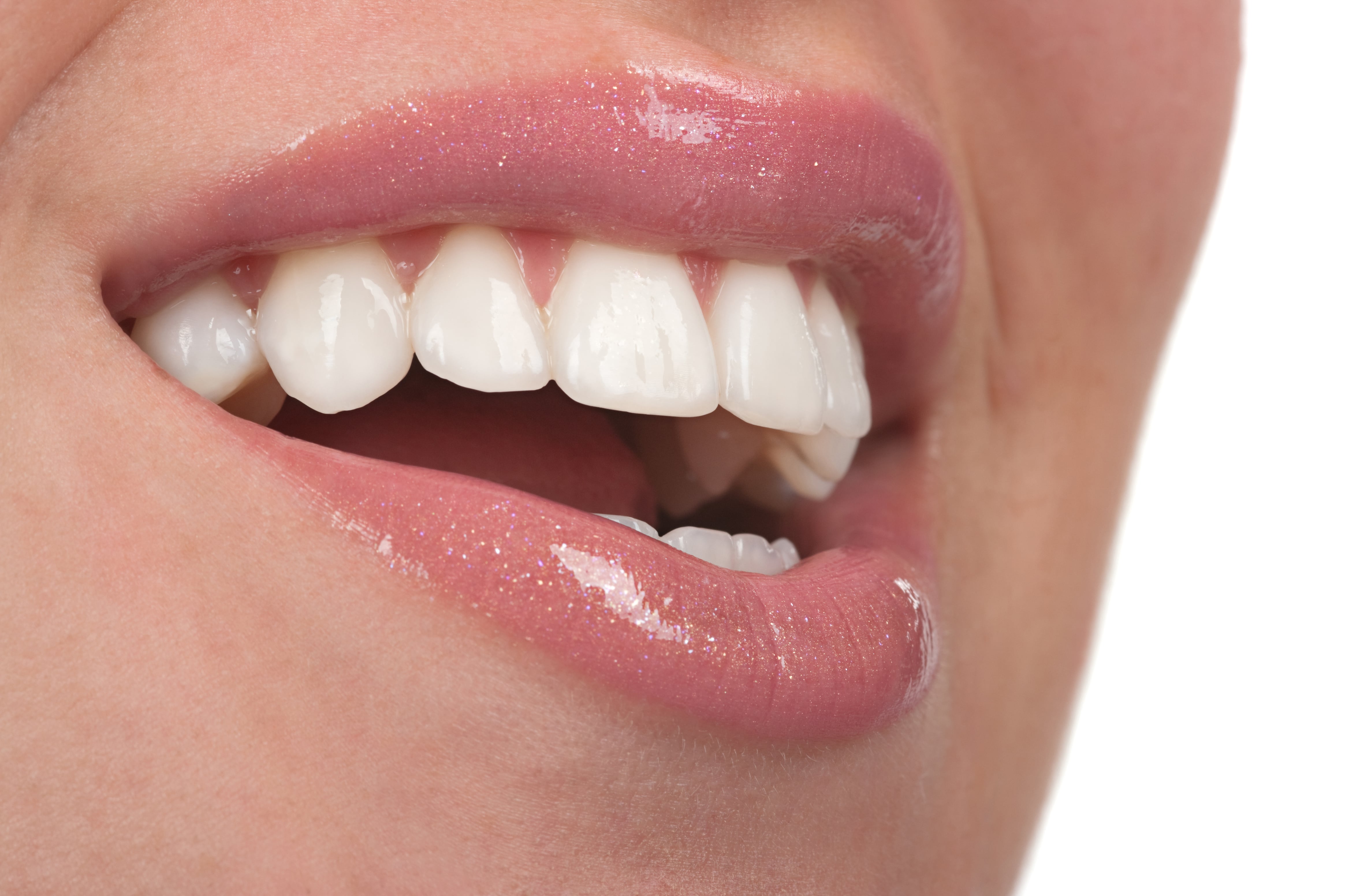 How Do Cosmetic Veneers Completely Alter A Smile? Astoria, NY