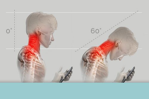 Cell Phone Use is Bad For Your Back Leigh Brain & Spine