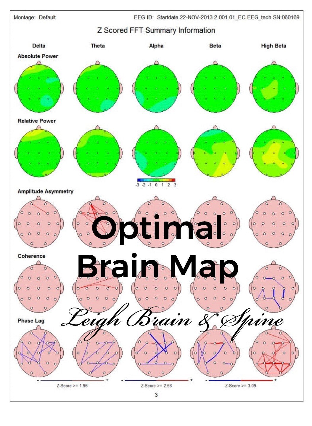 Eeg Brain Map Aurie Shaylyn