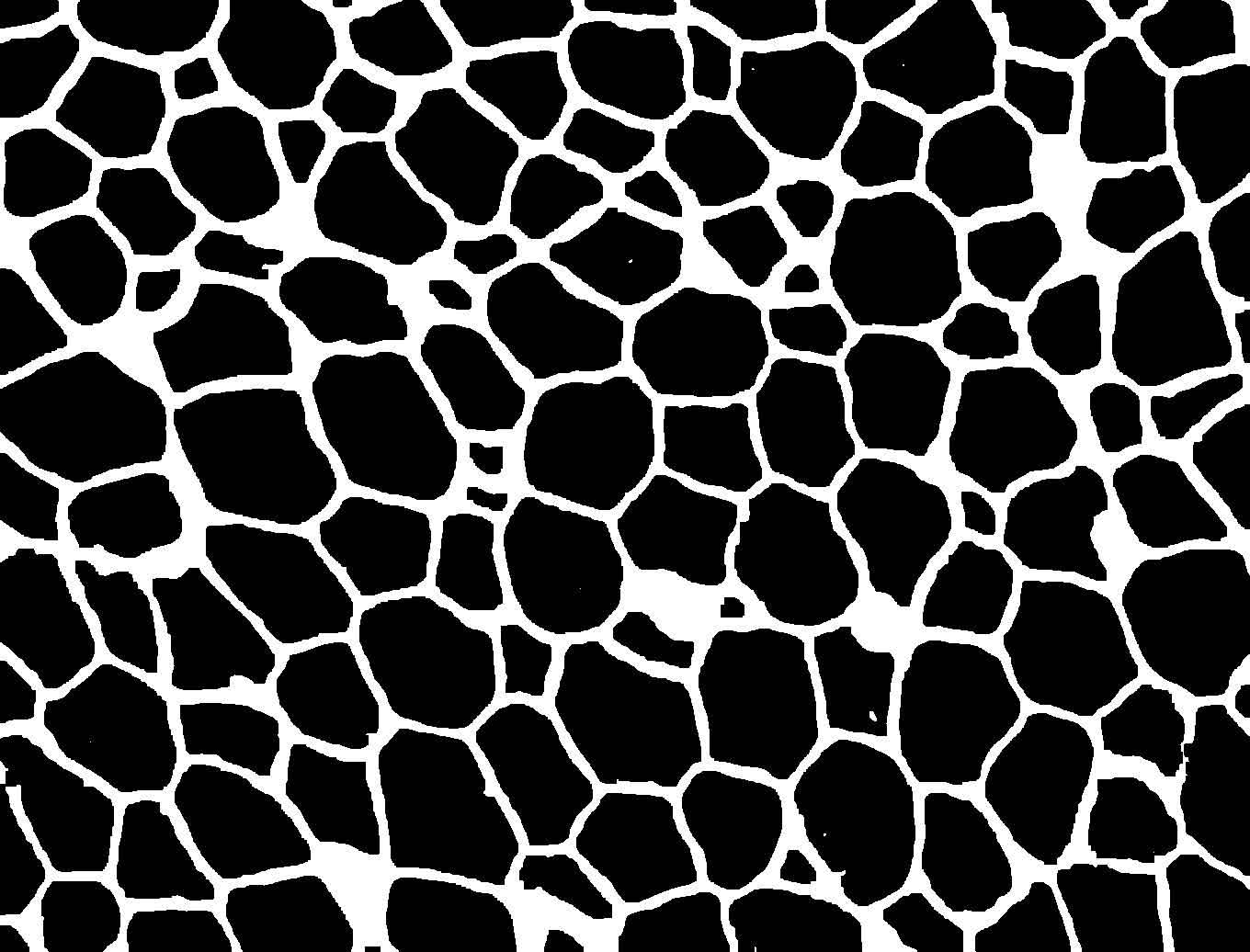 Quantifying Lipid Droplet Area with ImageJ