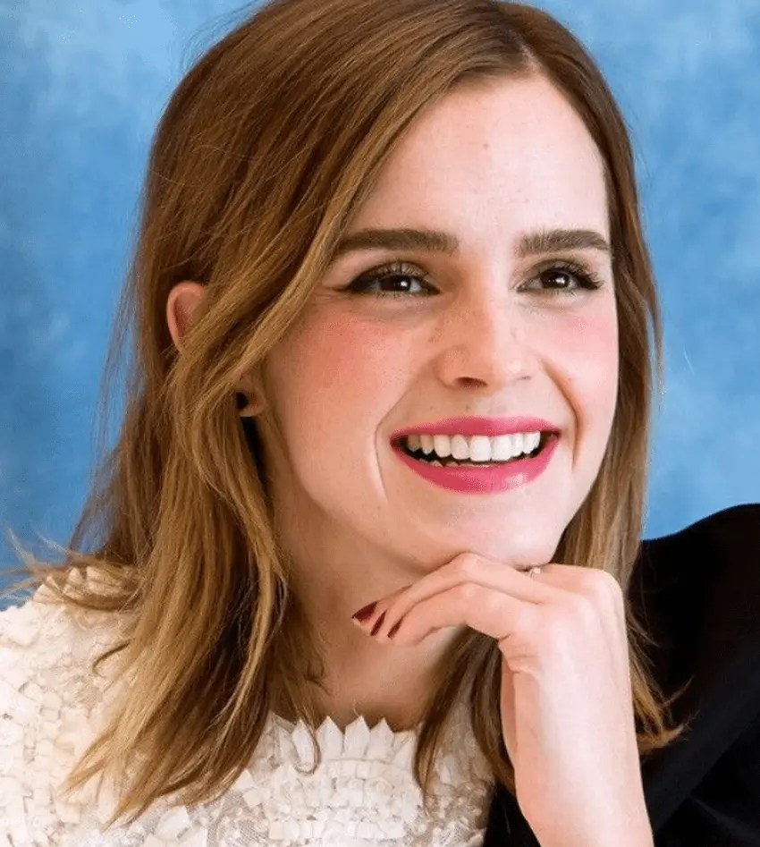 Emma Watsons nye tannforandring gjennom årene