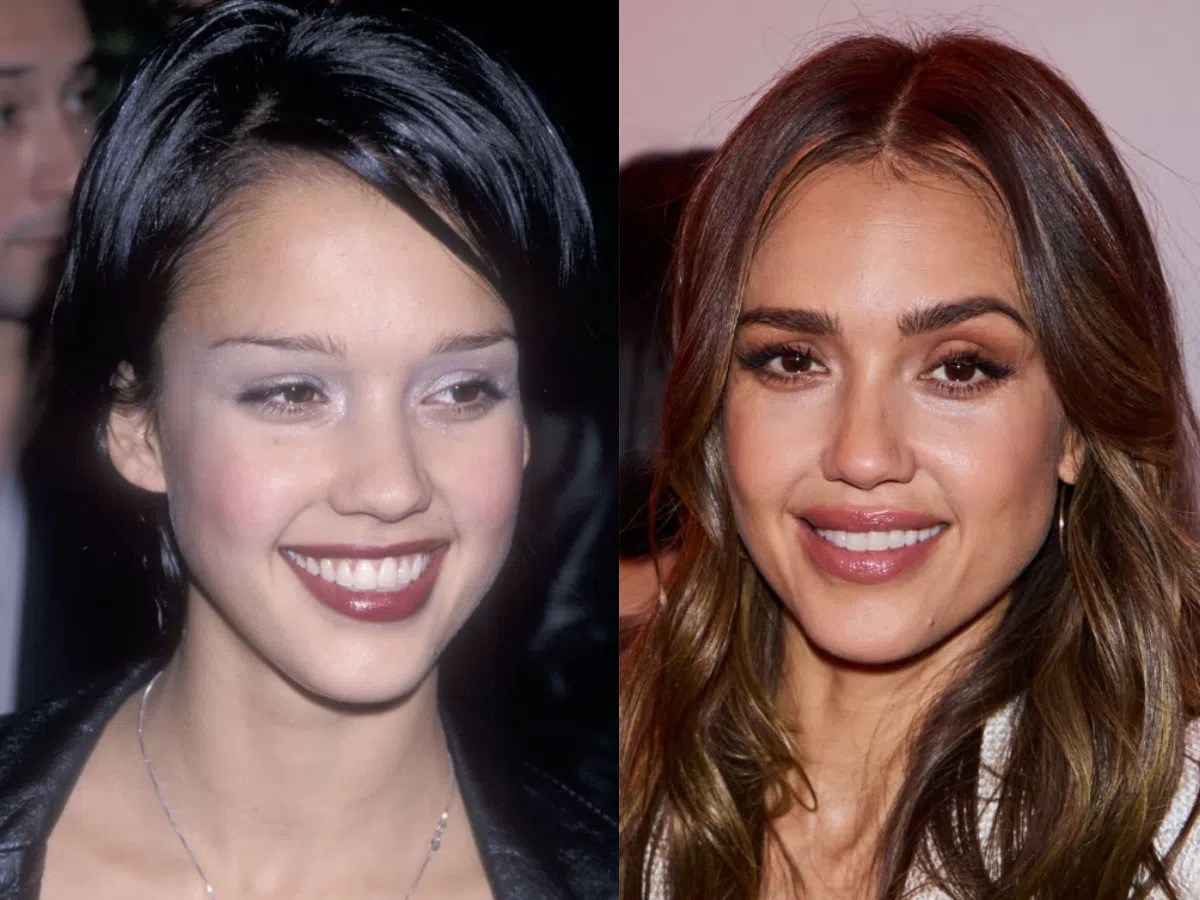 Jessica Alba Plastic Surgery Before And After Photos