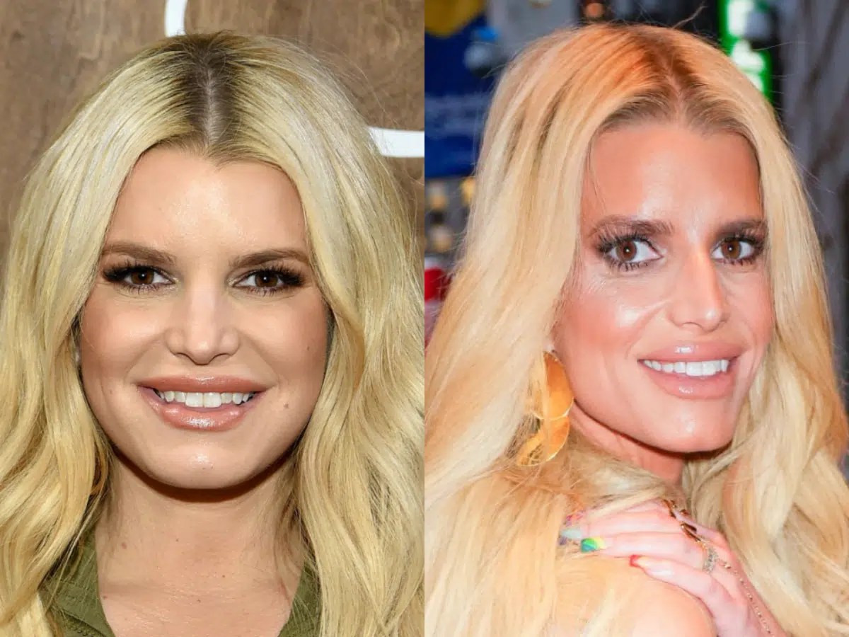 Sydney Sweeney’s Smile Secret What Did She Get Done? LEMA