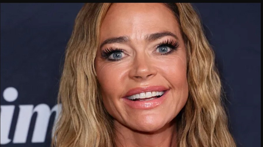 👱‍♀️ Зъбите на Deniz Richards (стари/нови) Преди и след