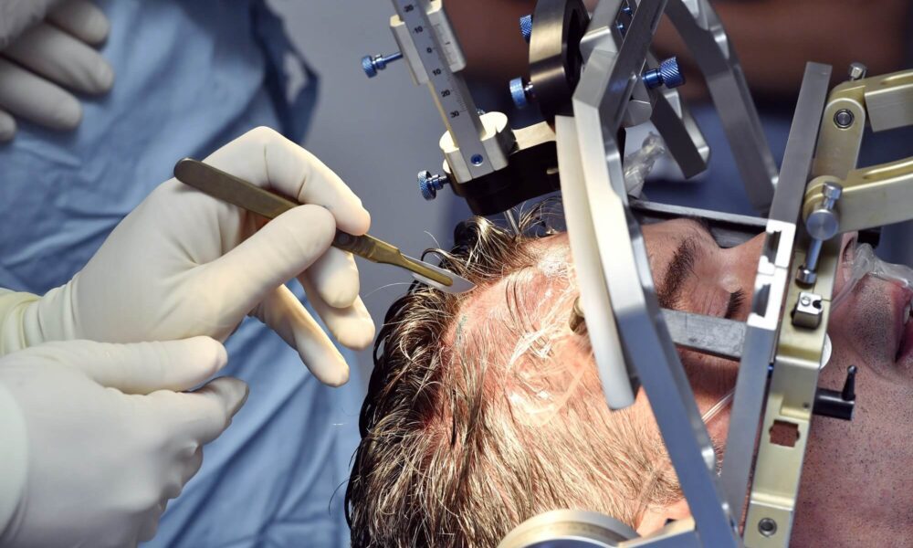 How Does Deep Brain Stimulation Work? Lemony Blog