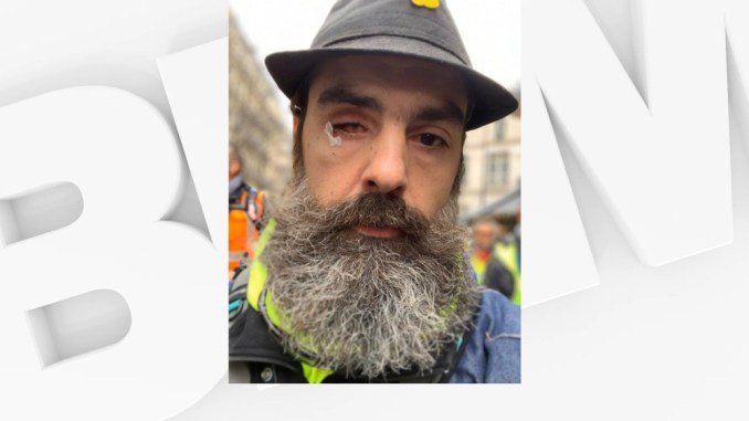 Le Gilet Jaune Jérôme Rodrigues Blessé Pendant Une