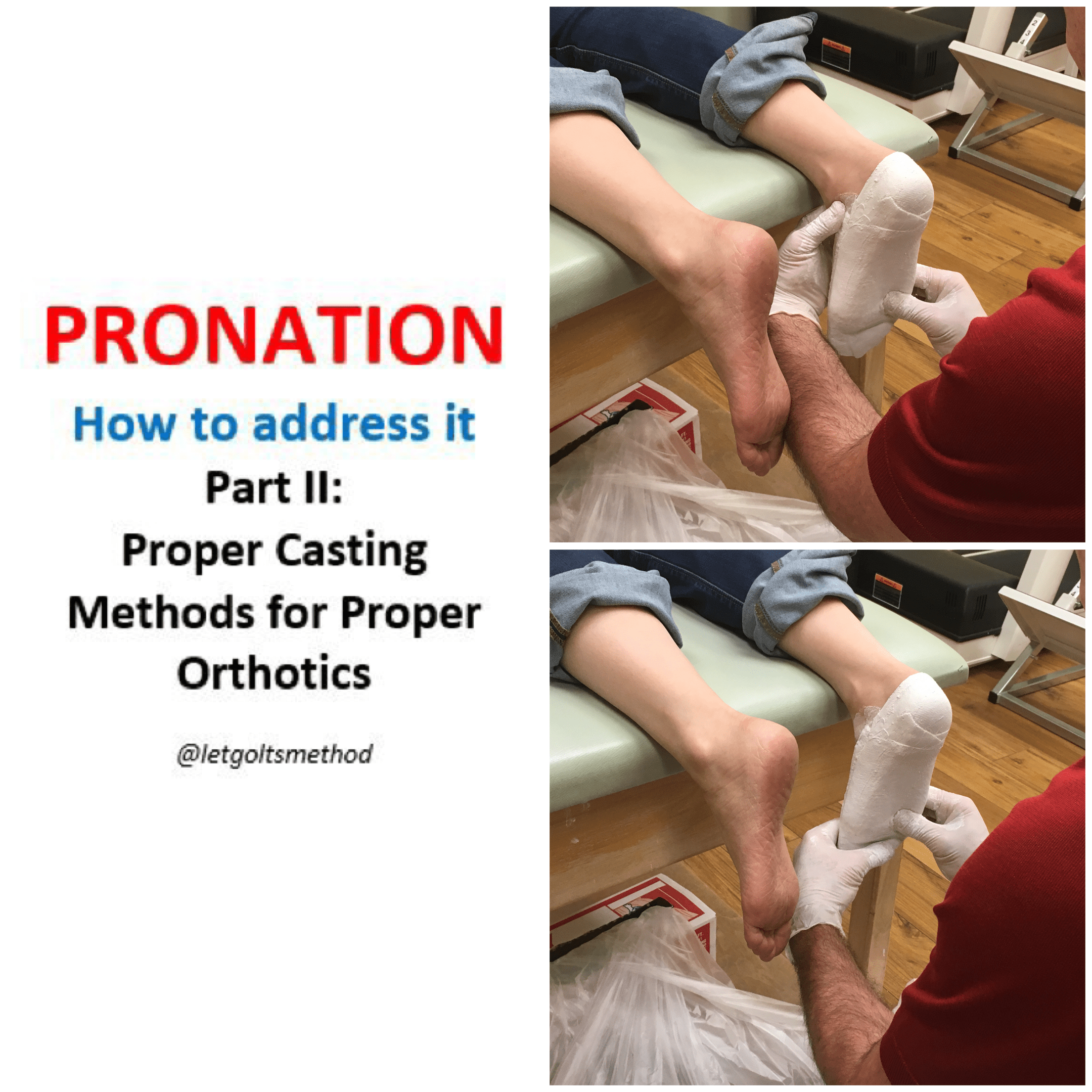 Pronation Part VII How to Address Pronation II Casting for Orthotics
