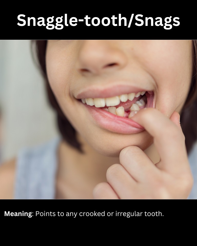 17+ Slang Words For Teeth (And How To Use Them)