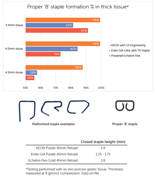 Surgical Stapling for HPB Surgery Lexington Medical