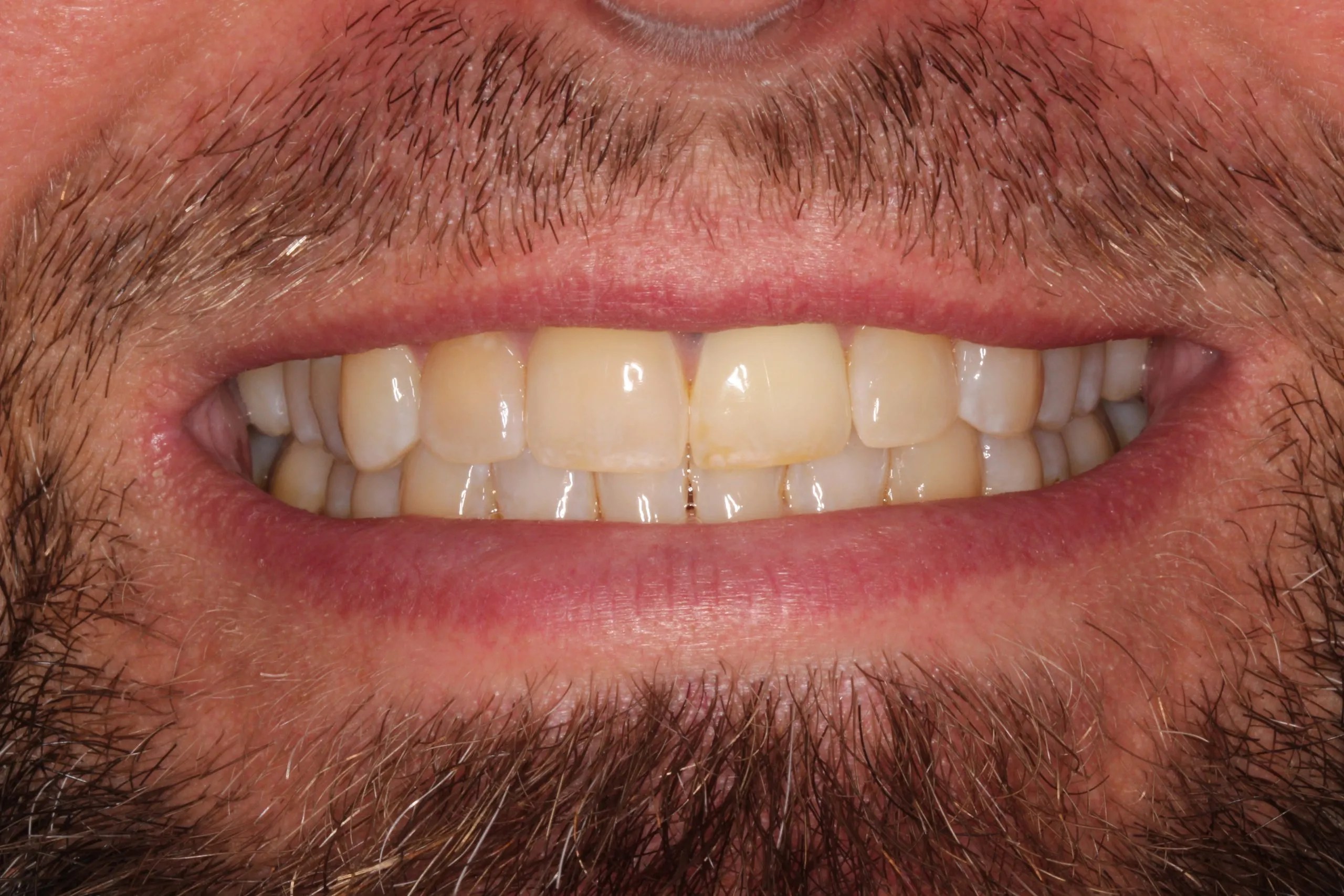Dentist in Lexington, KY Commonwealth Smiles Smile Gallery