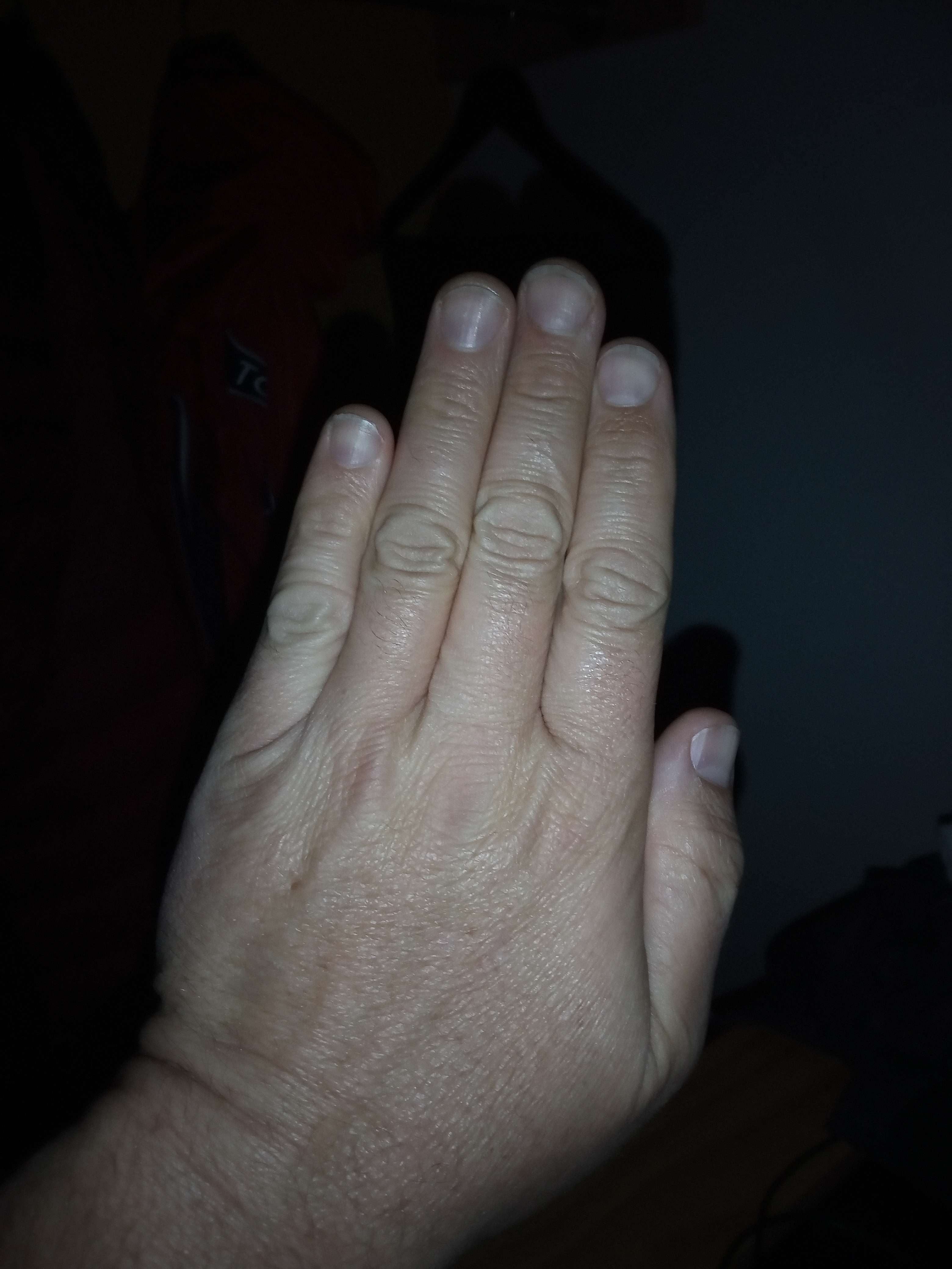 Are you doublejointed? Is it a blessing or a curse on your instrument