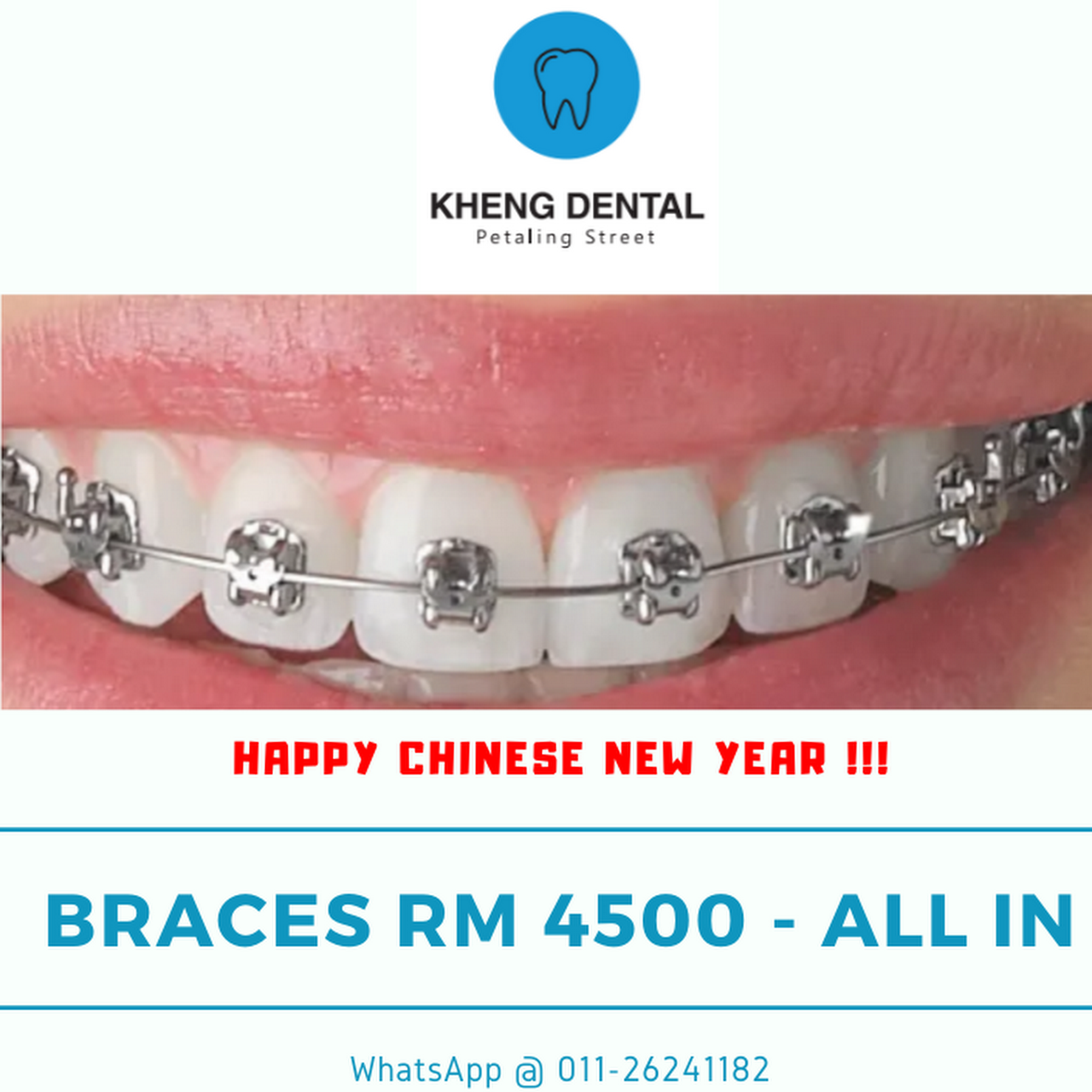 Klinik Pergigian Kheng Braces Whitening Veneer