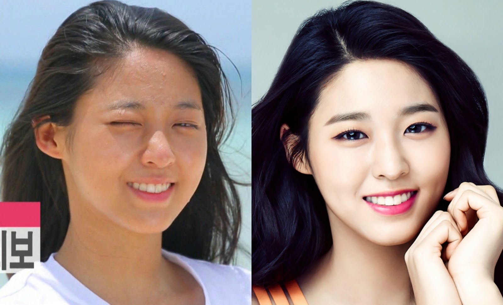 20 Idols Whose Skin Was Tragically Damaged By Makeup