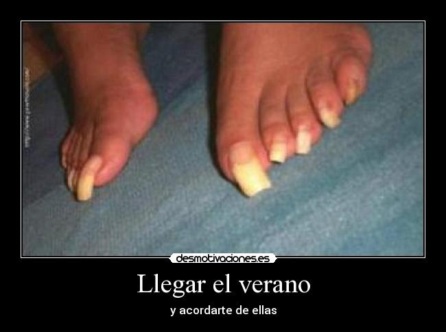 Uñas largas de los pies. Uñas Largas De Los Pies Memes - unas decoradas