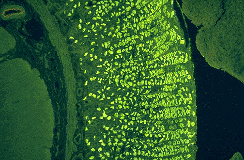 Antiparietal Antibody xidype83 痞客邦