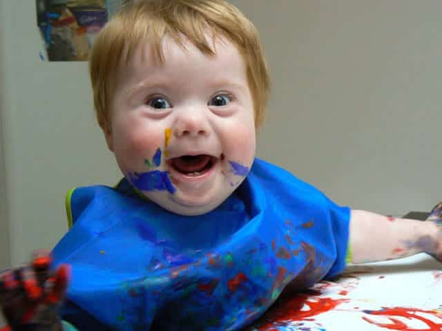 Turn That Frown Upside Down Meet 11 Down Syndrome Babies Who Will Make