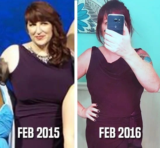 What I Learned About My Breast Reduction & Recovery Life She Has