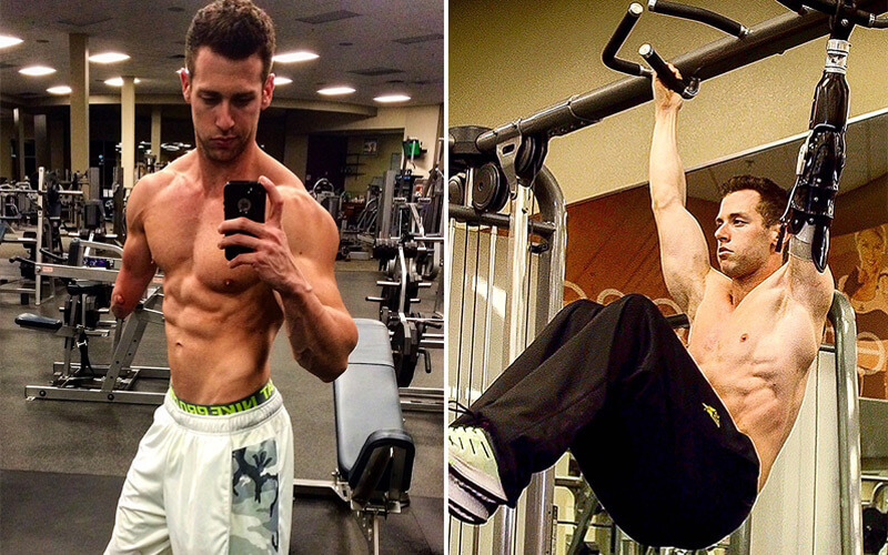 1Armed Bodybuilder gets Custom Prosthetic Arm that Proves nothing is