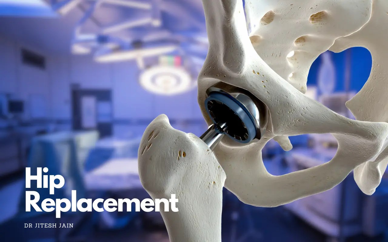 Best Hip Replacement Surgeon in Jaipur Dr Jitesh Jain Ligaments and Joints Suregery