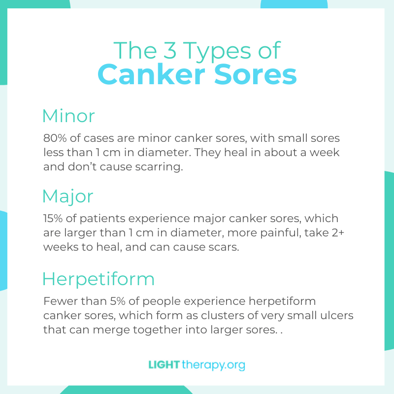 Canker Sores Light Therapy
