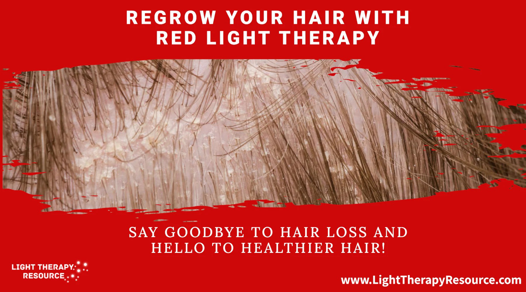 Light Therapy for Hair Regrowth! Light Therapy Resource