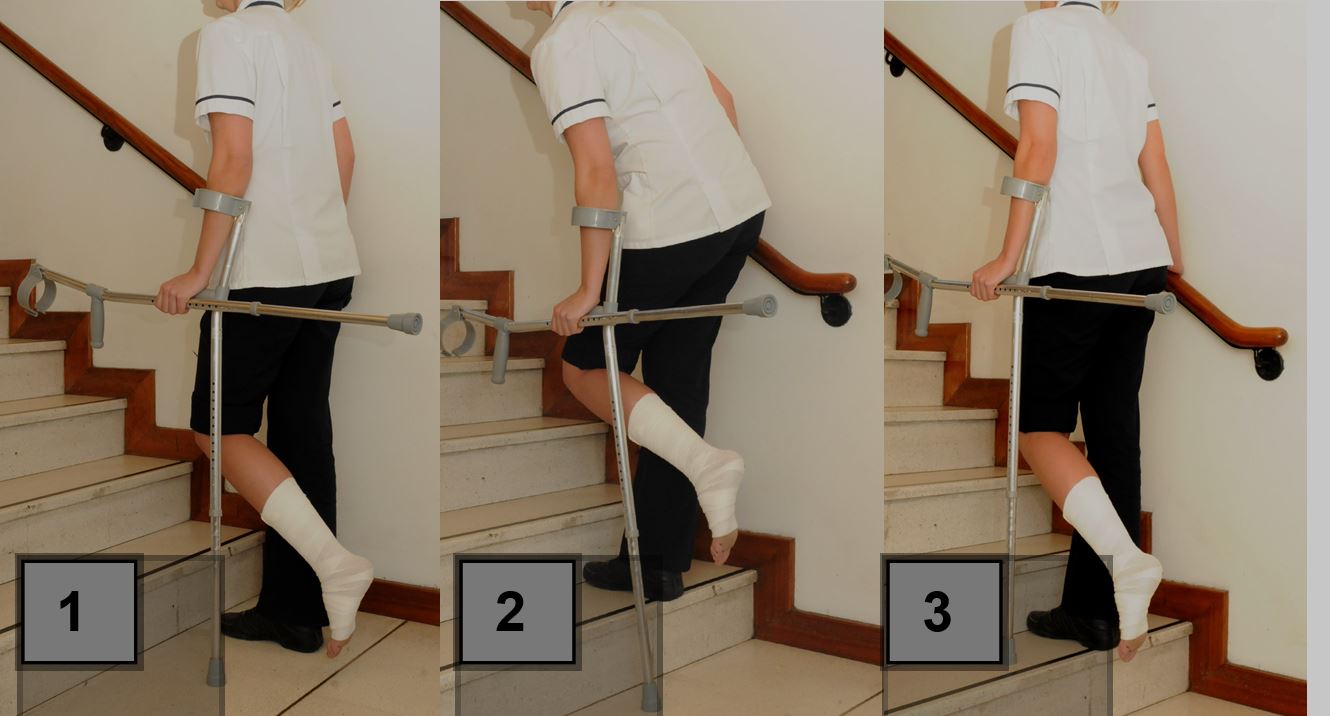 Stairs Technique Nonweight Bearing [One Rail]