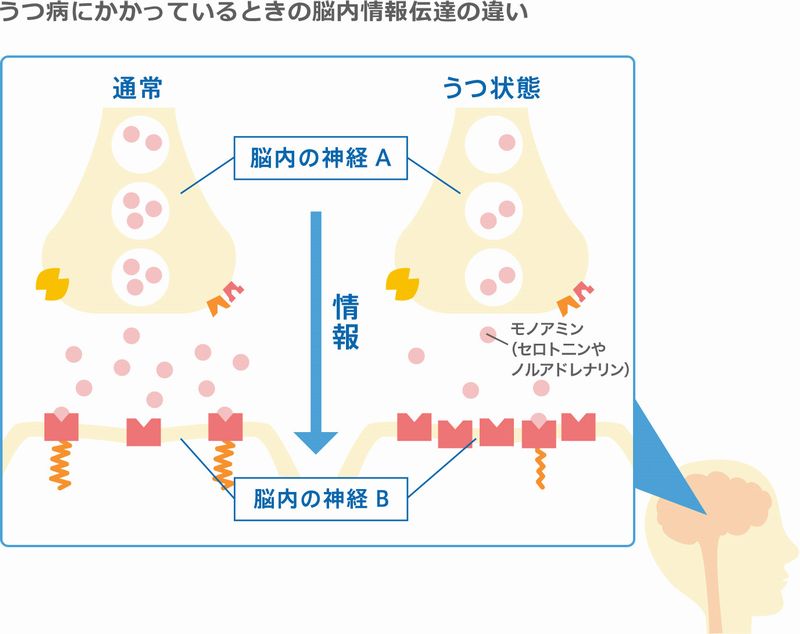 うつ病に効果｜リラクミンSEで セロトニン不足を解消