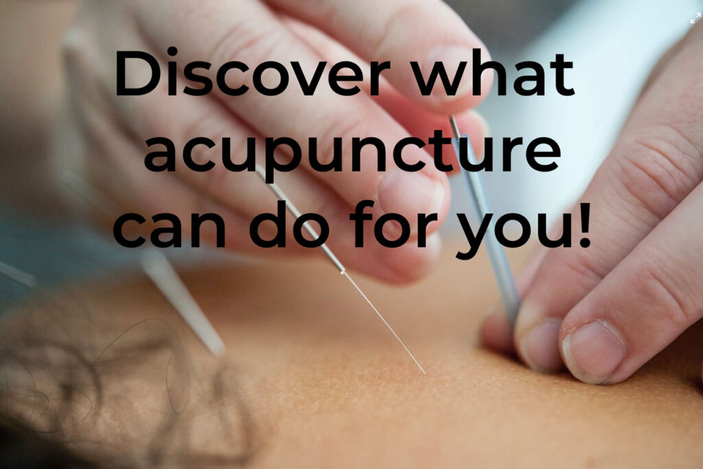 Acupuncturists What Can They Do For You? Limits of Strategy