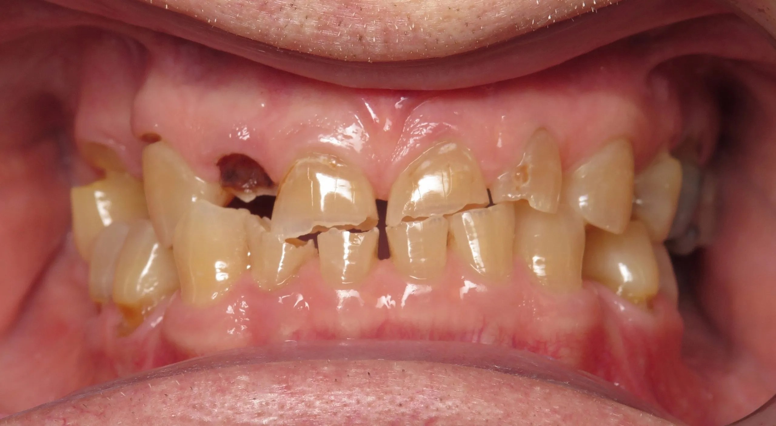 Rockford, IL Dentist Lindsten Dentistry Smile Gallery