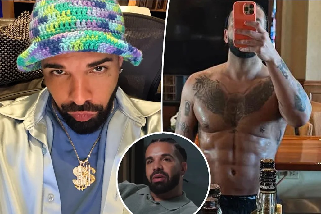 Did Drake Get a BBL? What's the truth? LIN