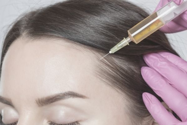 How Much Does PRP Cost For Hair Loss? (UK & Abroad) Linia Skin Clinic