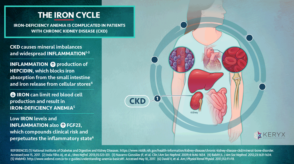 Iron Deficiency & Chronic Kidney Disease Link Studio