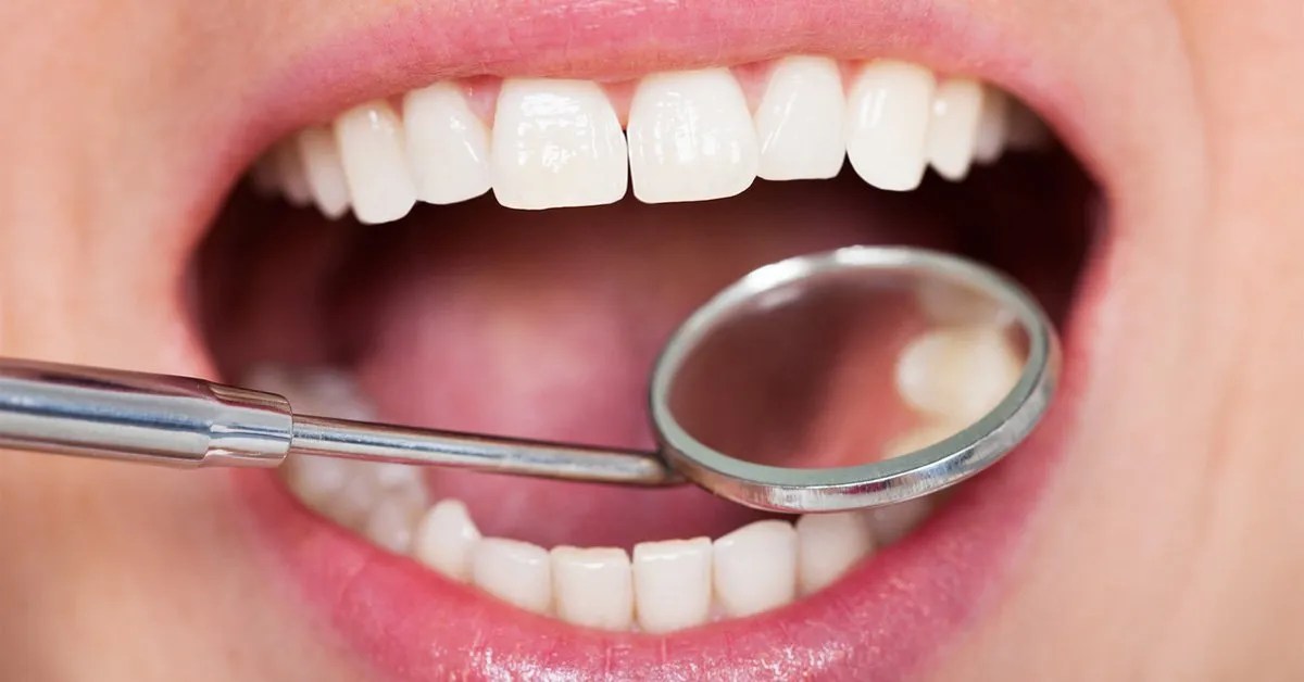 Tooth Filling Options Metal or Composite?