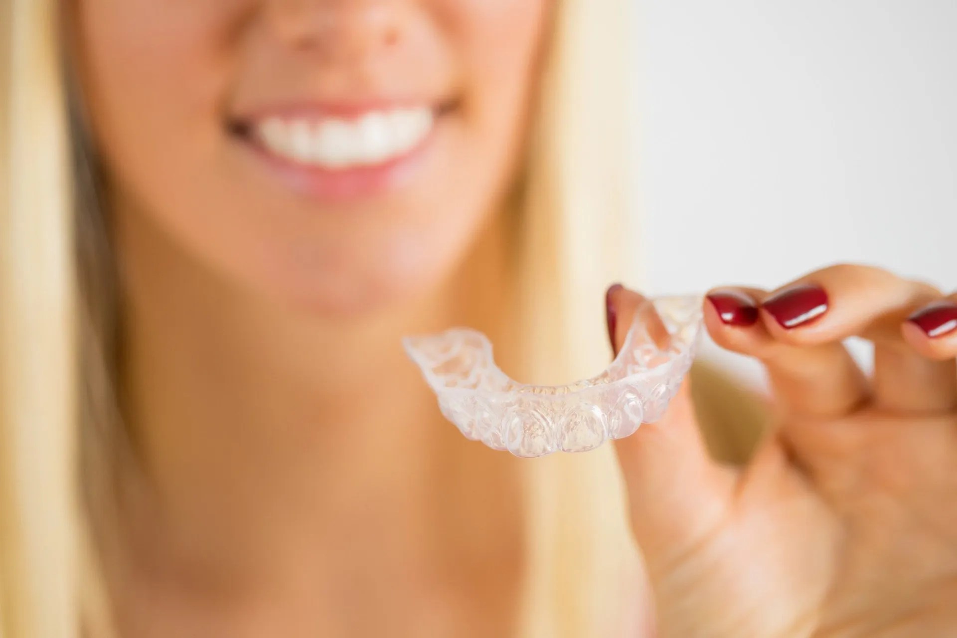 How To Get Invisalign Things To Know Before Getting Invisalign