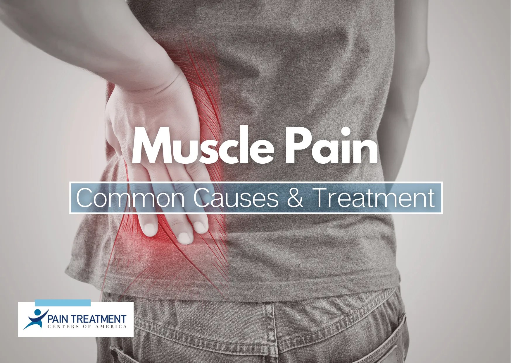 Muscle Pain Common Causes & Treatment