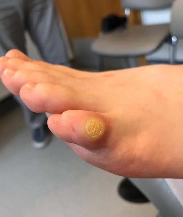 Details more than 150 shoe corn latest kenmei.edu.vn