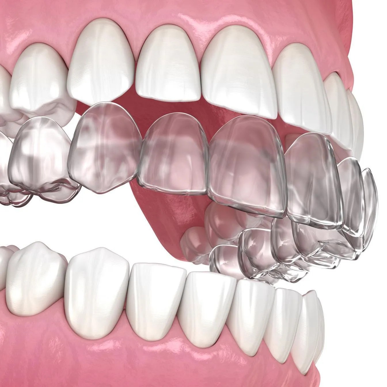 DC Implant & Cosmetic Dentistry 1 Implant Dentist In Washington DC